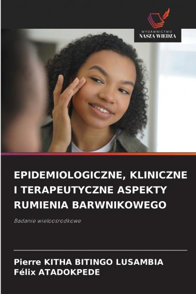 EPIDEMIOLOGICZNE KLINICZNE I TERAPEUTYCZNE ASPEKTY RUMIENIA BARWNIKOWEGO