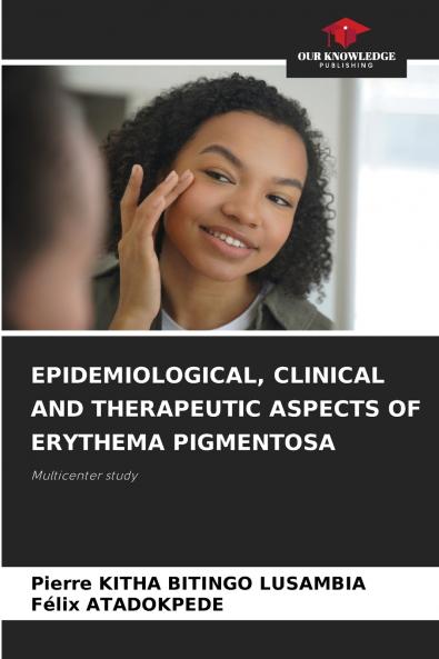 EPIDEMIOLOGICAL CLINICAL AND THERAPEUTIC ASPECTS OF ERYTHEMA PIGMENTOSA