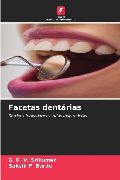Facetas dentárias