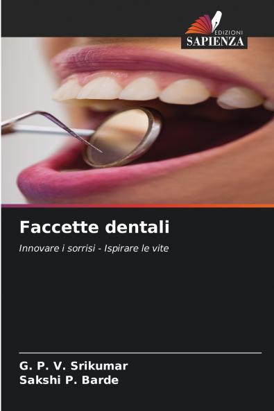 Faccette dentali