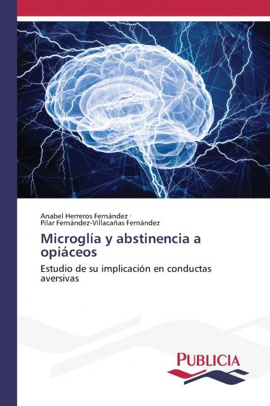 Microglía y abstinencia a opiáceos