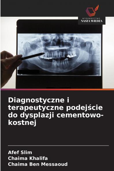 Diagnostyczne i terapeutyczne podejście do dysplazji cementowo-kostnej
