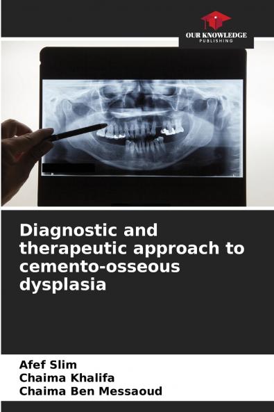 Diagnostic and therapeutic approach to cemento-osseous dysplasia