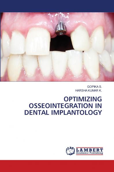 OPTIMIZING OSSEOINTEGRATION IN DENTAL IMPLANTOLOGY