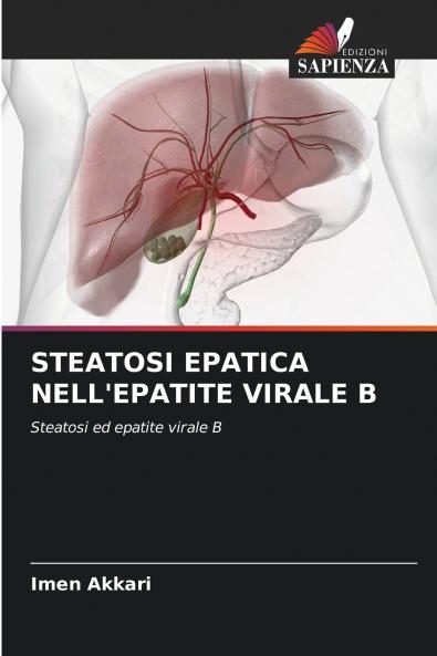 STEATOSI EPATICA NELL'EPATITE VIRALE B