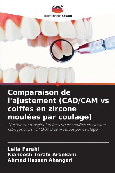 Comparaison de l'ajustement (CAD/CAM vs coiffes en zircone moulées par coulage)