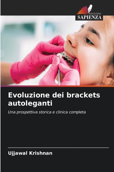 Evoluzione dei brackets autoleganti