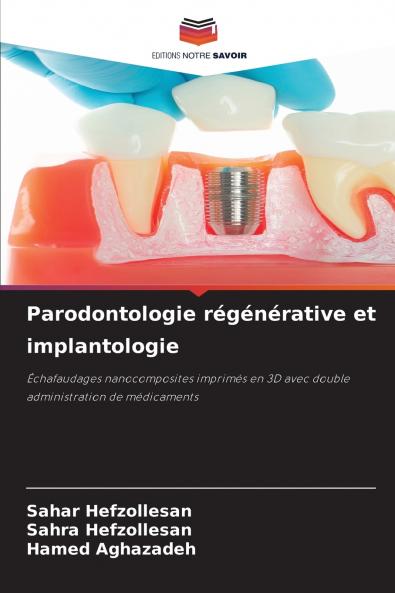 Parodontologie régénérative et implantologie