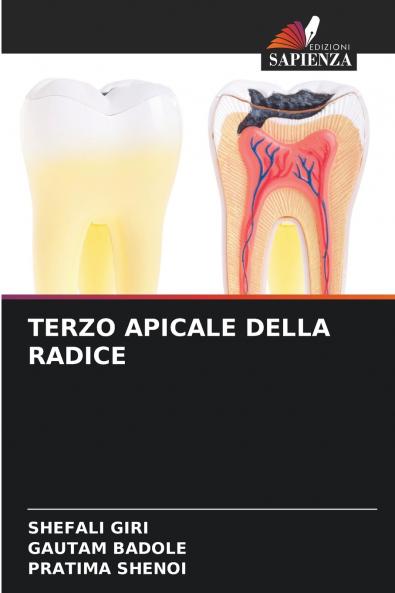 TERZO APICALE DELLA RADICE