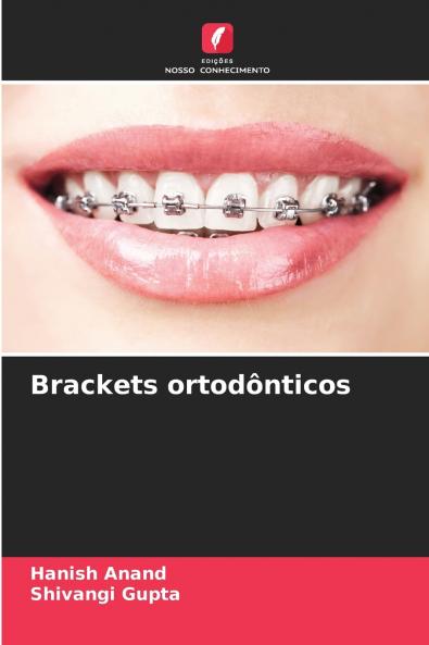 Brackets ortodônticos