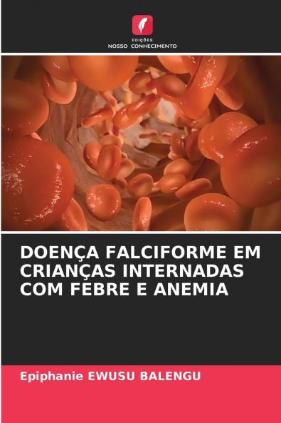 DOENÇA FALCIFORME EM CRIANÇAS INTERNADAS COM FEBRE E ANEMIA