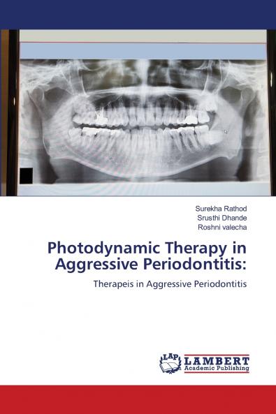 Photodynamic Therapy in Aggressive Periodontitis