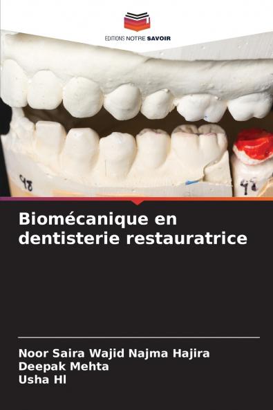 Biomécanique en dentisterie restauratrice