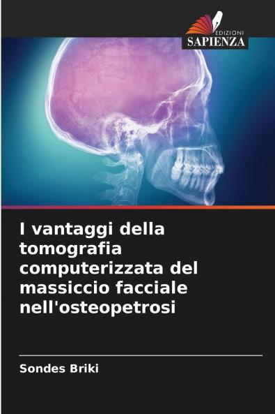 I vantaggi della tomografia computerizzata del massiccio facciale nell'osteopetrosi