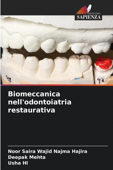 Biomeccanica nell'odontoiatria restaurativa