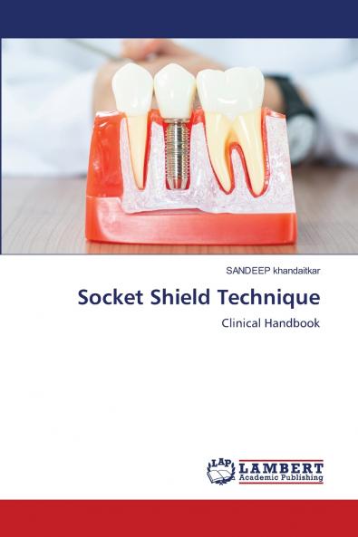 Socket Shield Technique