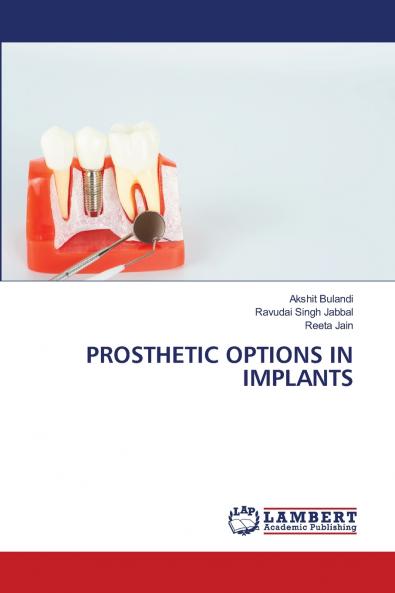 PROSTHETIC OPTIONS IN IMPLANTS
