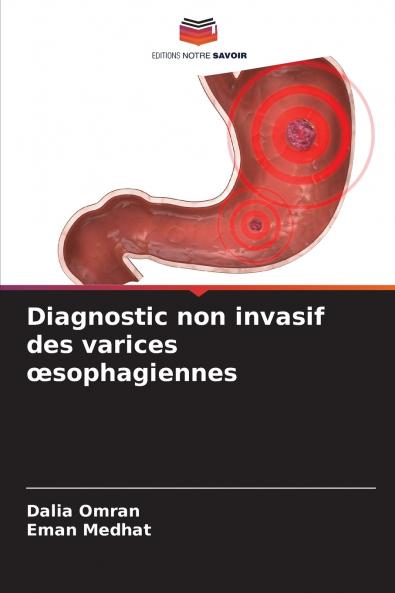 Diagnostic non invasif des varices œsophagiennes