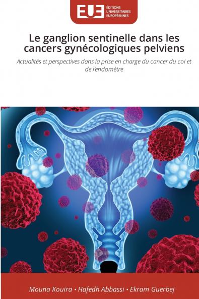 Le ganglion sentinelle dans les cancers gynécologiques pelviens