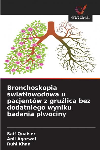Bronchoskopia światłowodowa u pacjentów z gruźlicą bez dodatniego wyniku badania plwociny