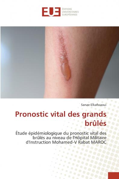 Pronostic vital des grands brûlés