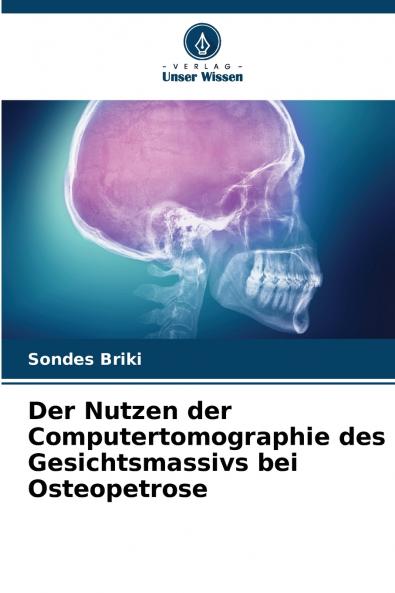 Der Nutzen der Computertomographie des Gesichtsmassivs bei Osteopetrose