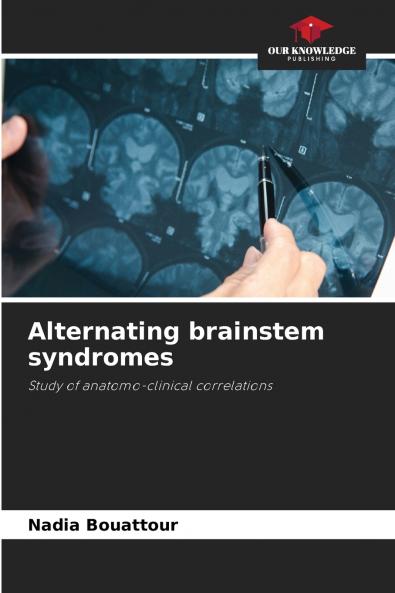 Alternating brainstem syndromes