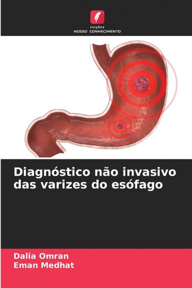 Diagnóstico não invasivo das varizes do esófago