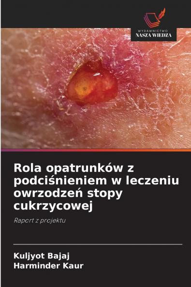 Rola opatrunków z podciśnieniem w leczeniu owrzodzeń stopy cukrzycowej