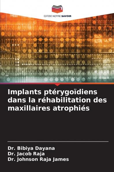 Implants ptérygoïdiens dans la réhabilitation des maxillaires atrophiés