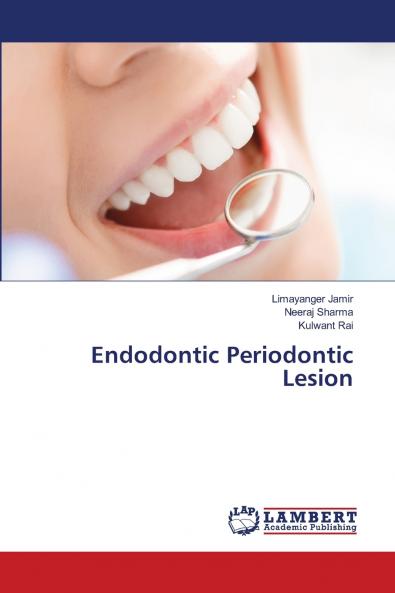 Endodontic Periodontic Lesion
