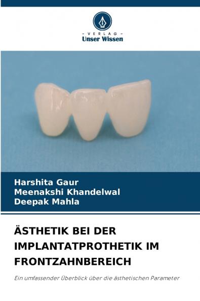 ÄSTHETIK BEI DER IMPLANTATPROTHETIK IM FRONTZAHNBEREICH