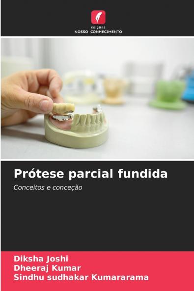 Prótese parcial fundida