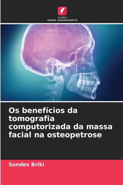 Os benefícios da tomografia computorizada da massa facial na osteopetrose