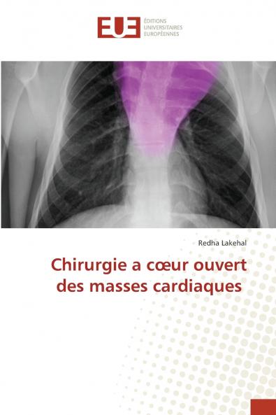 Chirurgie a cœur ouvert des masses cardiaques