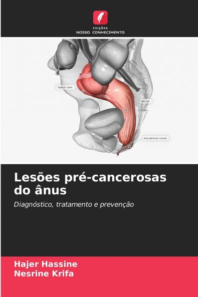 Lesões pré-cancerosas do ânus