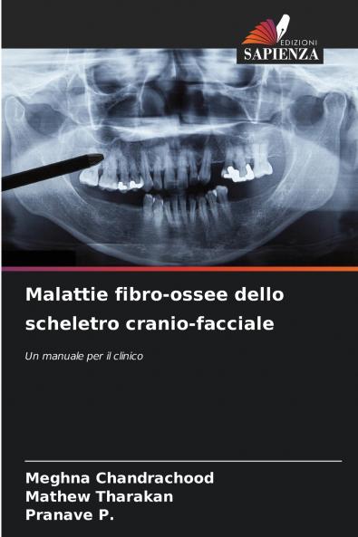 Malattie fibro-ossee dello scheletro cranio-facciale