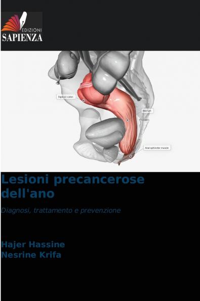 Lesioni precancerose dell'ano