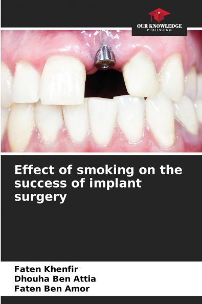 Effect of smoking on the success of implant surgery