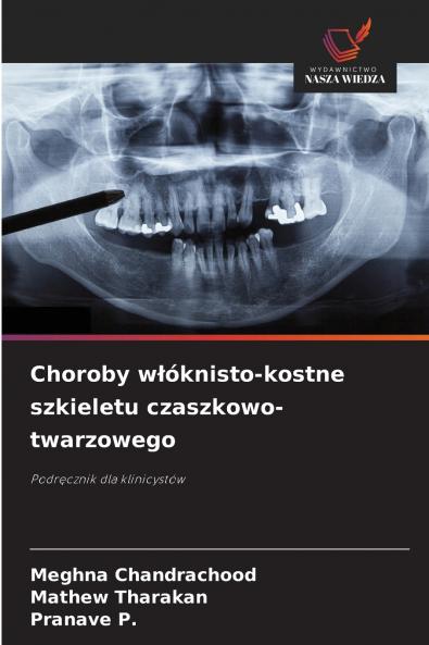 Choroby włóknisto-kostne szkieletu czaszkowo-twarzowego