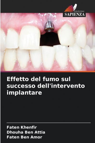 Effetto del fumo sul successo dell'intervento implantare