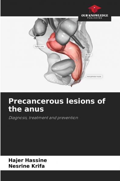 Precancerous lesions of the anus