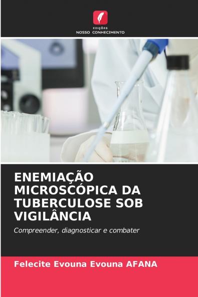 ENEMIAÇÃO MICROSCÓPICA DA TUBERCULOSE SOB VIGILÂNCIA