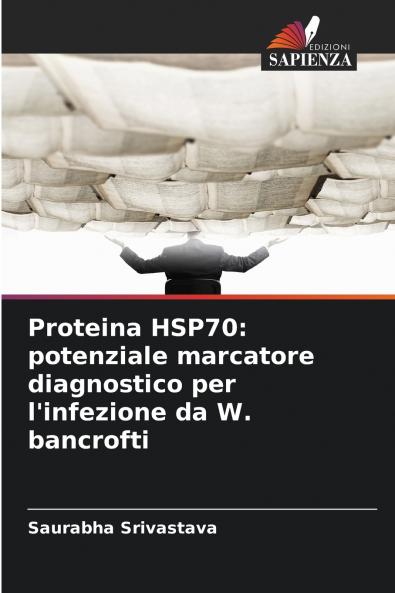 Proteina HSP70