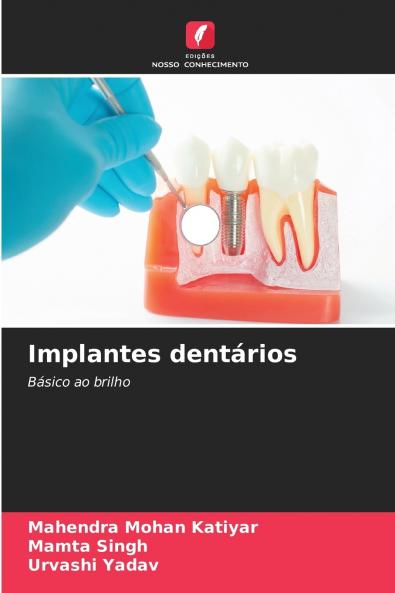 Implantes dentários