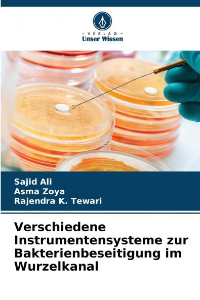 Verschiedene Instrumentensysteme zur Bakterienbeseitigung im Wurzelkanal