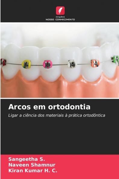 Arcos em ortodontia