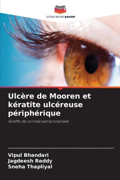 Ulcère de Mooren et kératite ulcéreuse périphérique