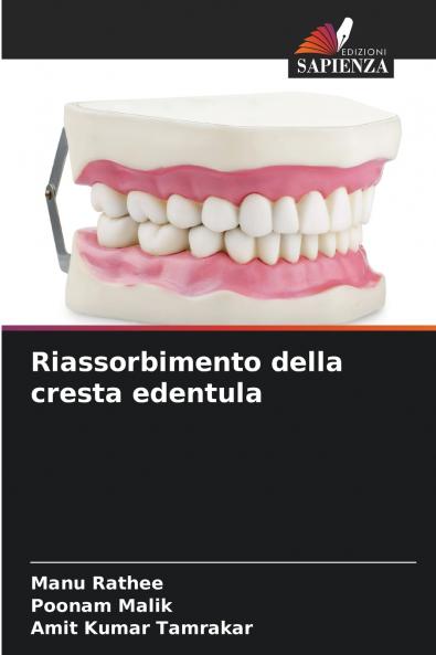 Riassorbimento della cresta edentula