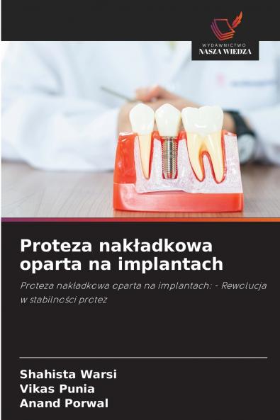 Proteza nakładkowa oparta na implantach